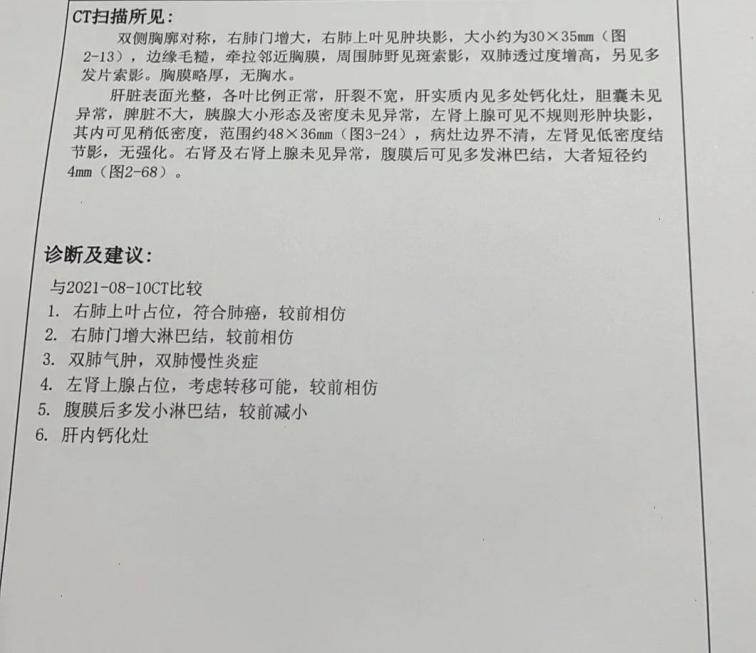 贝达药业:盐酸恩沙替尼胶囊在美国开出首张处方单