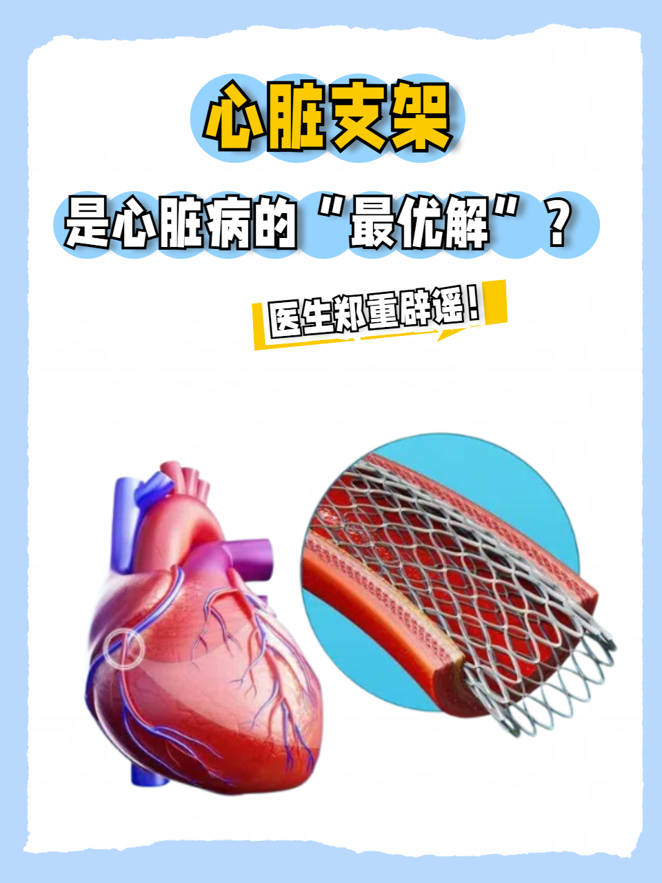 科学与健康丨中国“心”中国造 这颗“心脏”不一般！