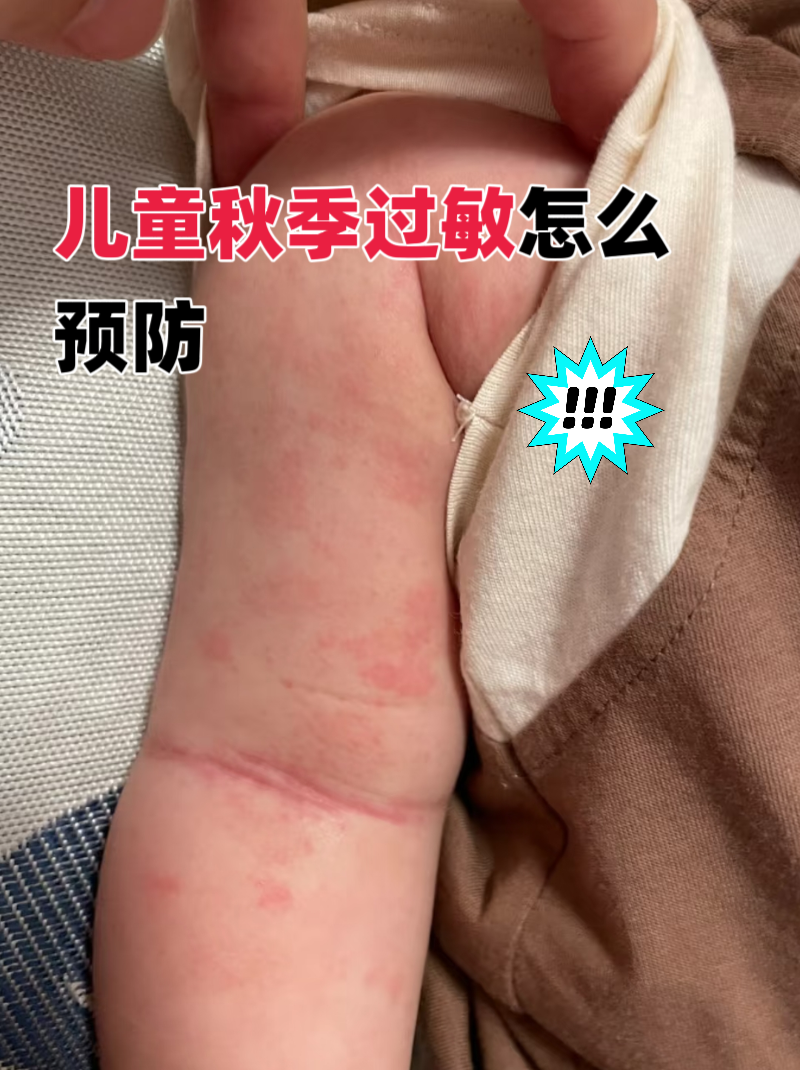 儿童过敏能“长大自愈”？医生提醒春季过敏防控别陷误区